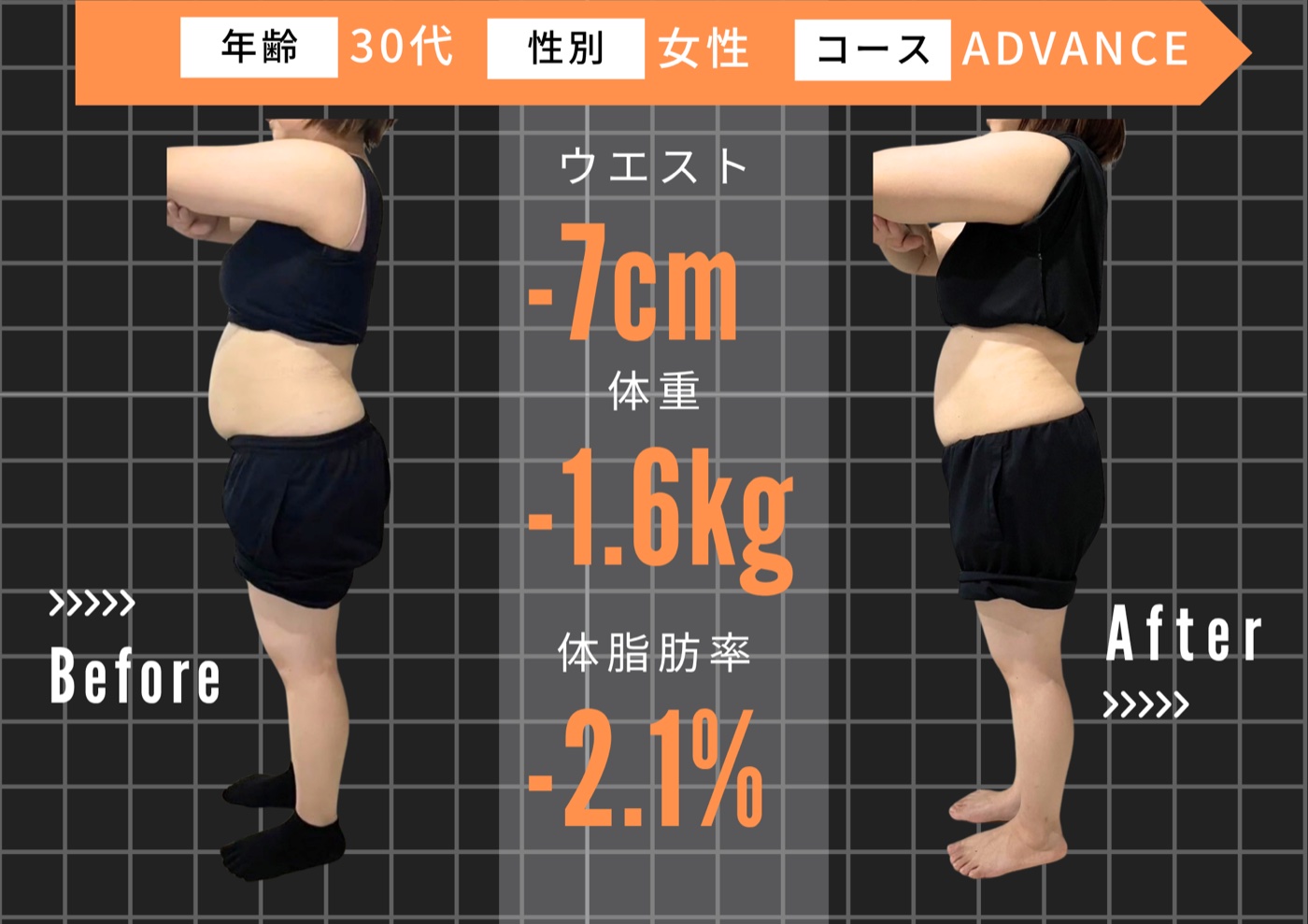 30代 女性 ／ ADVANCEコース ビフォーアフター
