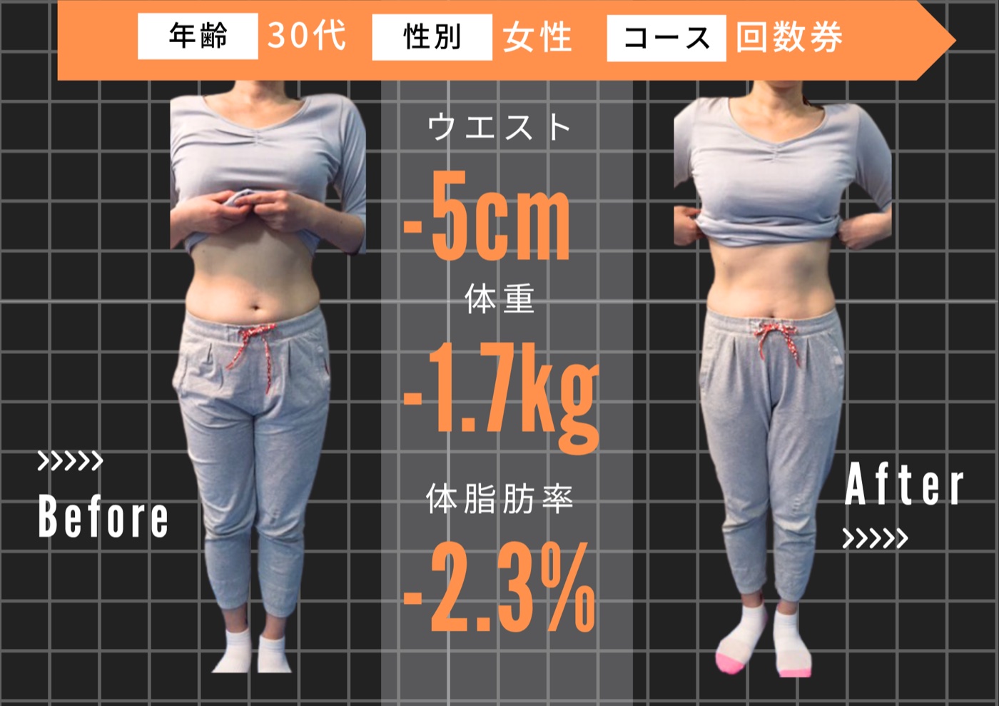30代 女性 ／ 回数券プラン ビフォーアフター