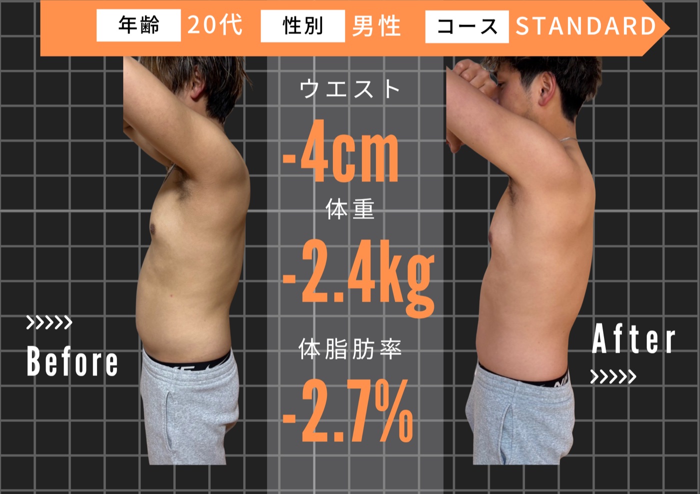 20代 男性 ／ STANDARDコース ビフォーアフター
